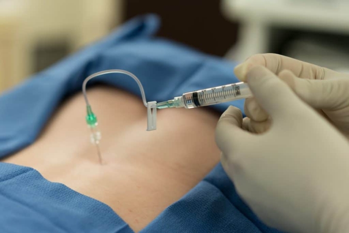 Epidural Injections in St. George, Utah